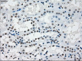 m14965 anti protein kinase y linked prky mouse monoclonal antibody clone id oti3e10 ihc testing 14