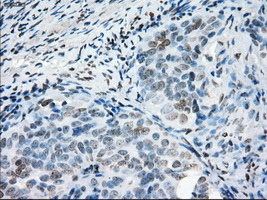 m14965 anti protein kinase y linked prky mouse monoclonal antibody clone id oti3e10 ihc testing 3