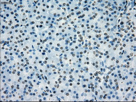 m14965 anti protein kinase y linked prky mouse monoclonal antibody clone id oti3e10 ihc testing 4