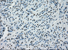 m14965 anti protein kinase y linked prky mouse monoclonal antibody clone id oti3e10 ihc testing 6