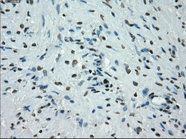 m14965 anti protein kinase y linked prky mouse monoclonal antibody clone id oti3e10 ihc testing 8