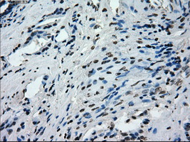 m14965 anti protein kinase y linked prky mouse monoclonal antibody clone id oti3e10 ihc testing 9
