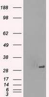 m14965 anti protein kinase y linked prky mouse monoclonal antibody clone id oti3e10 wb testing 1