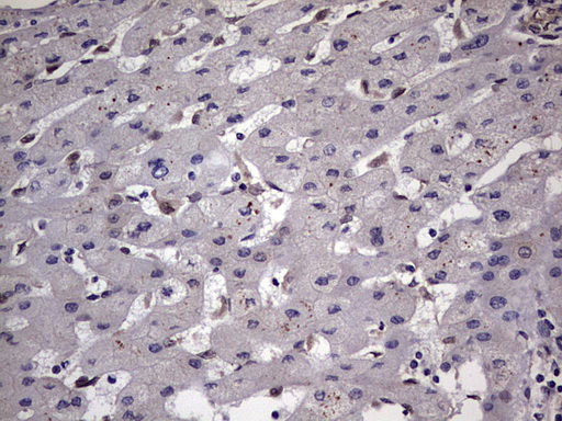 m15027 anti znf286 znf286a mouse monoclonal antibody clone id oti7d2 ihc testing 11