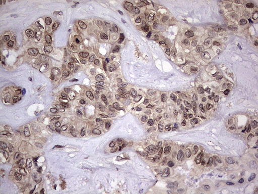 m15027 anti znf286 znf286a mouse monoclonal antibody clone id oti7d2 ihc testing 12