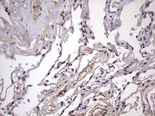m15027 anti znf286 znf286a mouse monoclonal antibody clone id oti7d2 ihc testing 13