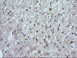 m15087 1 anti lzic mouse monoclonal antibody clone id oti5e3 ihc testing 11