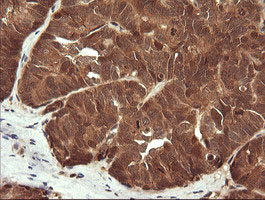m15087 1 anti lzic mouse monoclonal antibody clone id oti5e3 ihc testing 4