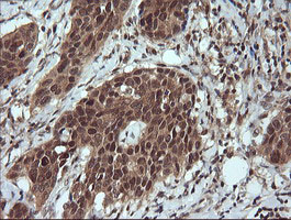 m15087 1 anti lzic mouse monoclonal antibody clone id oti5e3 ihc testing 6