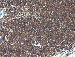 m15087 1 anti lzic mouse monoclonal antibody clone id oti5e3 ihc testing 7