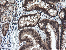 m15087 1 anti lzic mouse monoclonal antibody clone id oti5e3 ihc testing 8