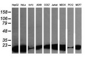 m15087 1 anti lzic mouse monoclonal antibody clone id oti5e3 wb testing 2