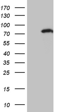 HEK293T cells were transfected with the pCMV6-ENTRY control (Left lane) or pCMV6-ENTRY ZNF264 (Right lane) cDNA for 48 hrs and lysed