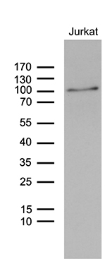 Western blot analysis of extracts (35ug) from Jurkat cell lines by using anti-ZNF264 monoclonal antibody (1:500)