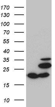 HEK293T cells were transfected with the pCMV6-ENTRY control (Left lane) or pCMV6-ENTRY MRPL48 (Right lane) cDNA for 48 hrs and lysed