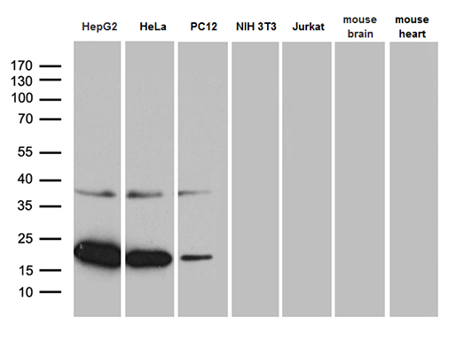 Western blot analysis of extracts (35ug) from 5 different cell lines and 2 different tissue lysates by using anti-MRPL48 monoclonal antibody (1:500)