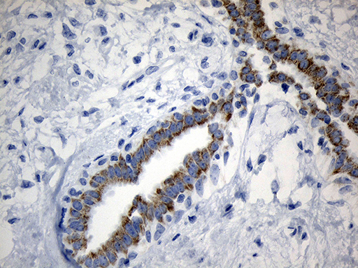 m15184 anti mrpl48 mouse monoclonal antibody clone id oti8e1 ihc testing 4
