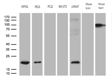 Western blot analysis of extracts (35ug) from 5 different cell lines and 2 different tissue lysates by using anti-MRPL48 monoclonal antibody (1:500)
