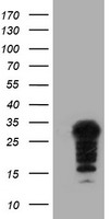 HEK293T cells were transfected with the pCMV6-ENTRY control (Left lane) or pCMV6-ENTRY SSX5 (Right lane) cDNA for 48 hrs and lysed