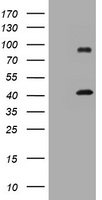 HEK293T cells were transfected with the pCMV6-ENTRY control (Left lane) or pCMV6-ENTRY MAGEA9 (Right lane) cDNA for 48 hrs and lysed