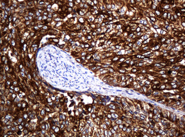 m15311 2 anti pogk mouse monoclonal antibody clone id oti6d5 ihc testing 10