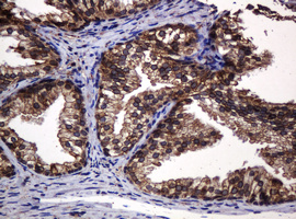 m15311 2 anti pogk mouse monoclonal antibody clone id oti6d5 ihc testing 11
