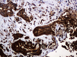 m15311 2 anti pogk mouse monoclonal antibody clone id oti6d5 ihc testing 12