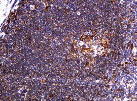 m15311 2 anti pogk mouse monoclonal antibody clone id oti6d5 ihc testing 13