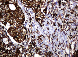 m15311 2 anti pogk mouse monoclonal antibody clone id oti6d5 ihc testing 16