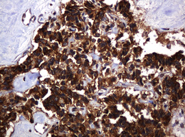 m15311 2 anti pogk mouse monoclonal antibody clone id oti6d5 ihc testing 6