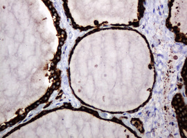 m15311 2 anti pogk mouse monoclonal antibody clone id oti6d5 ihc testing 7