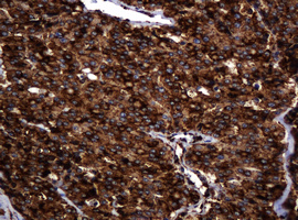 m15311 2 anti pogk mouse monoclonal antibody clone id oti6d5 ihc testing 8