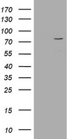 HEK293T cells were transfected with the pCMV6-ENTRY control (Left lane) or pCMV6-ENTRY POGK (Right lane) cDNA for 48 hrs and lysed
