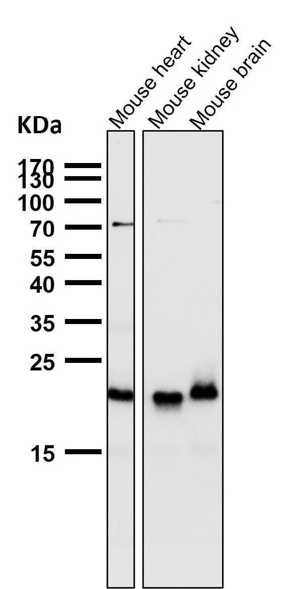 Western blot analysis of TIMM22 expression in A431 cell lysate.