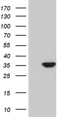 HEK293T cells were transfected with the pCMV6-ENTRY control (Left lane) or pCMV6-ENTRY PDIK1L (Right lane) cDNA for 48 hrs and lysed