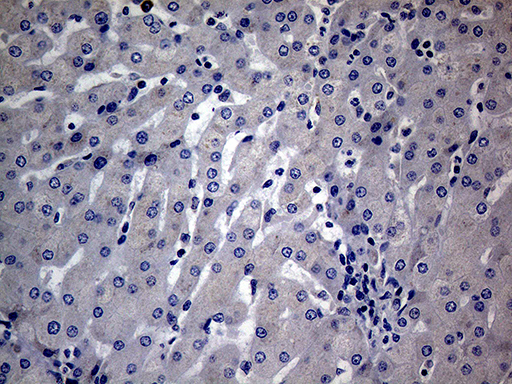 m15333 anti diras2 mouse monoclonal antibody clone id oti8a5 ihc testing 11