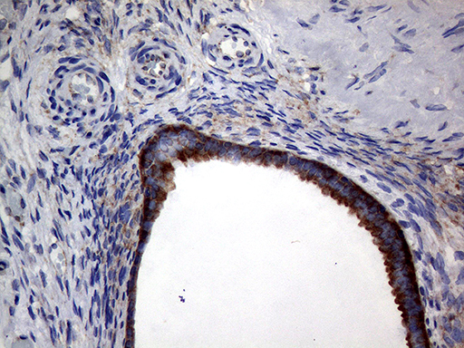 m15333 anti diras2 mouse monoclonal antibody clone id oti8a5 ihc testing 3