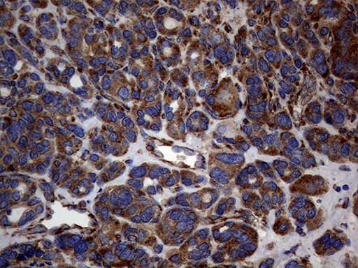 m15333 anti diras2 mouse monoclonal antibody clone id oti8a5 ihc testing 6