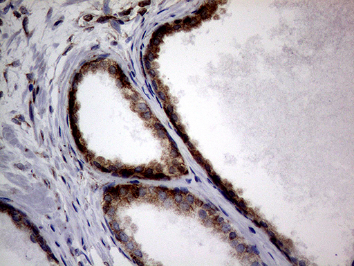 m15333 anti diras2 mouse monoclonal antibody clone id oti8a5 ihc testing 8