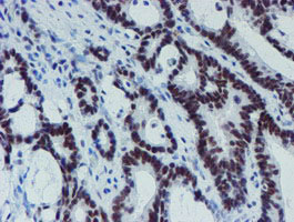 m15345 anti mett10d mettl16 mouse monoclonal antibody clone id oti3b5 ihc testing 10