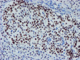 Immunohistochemical staining of paraffin-embedded Human pancreas tissue within the normal limits using anti-METT10D mouse monoclonal antibody