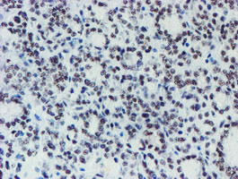 m15345 anti mett10d mettl16 mouse monoclonal antibody clone id oti3b5 ihc testing 4