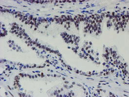 m15345 anti mett10d mettl16 mouse monoclonal antibody clone id oti3b5 ihc testing 6