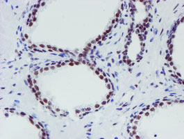 m15345 anti mett10d mettl16 mouse monoclonal antibody clone id oti3b5 ihc testing 7