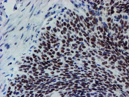 m15345 anti mett10d mettl16 mouse monoclonal antibody clone id oti3b5 ihc testing 8