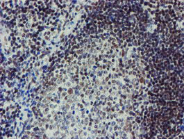m15345 anti mett10d mettl16 mouse monoclonal antibody clone id oti3b5 ihc testing 9