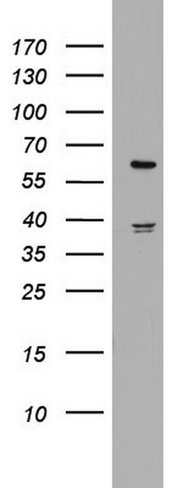 Western blot analysis of HT29 cell lysate (35ug) by using anti-HMGXB4 monoclonal antibody. Dilution: 1:500