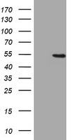 HEK293T cells were transfected with the pCMV6-ENTRY control (Left lane) or pCMV6-ENTRY HMGXB4 (Right lane) cDNA for 48 hrs and lysed. Equivalent amounts of cell lysates (5 ug per lane) were separated by SDS-PAGE and immunoblotted with anti-HMGXB4.