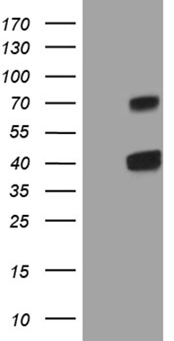 HEK293T cells were transfected with the pCMV6-ENTRY control (Left lane) or pCMV6-ENTRY CLEC1A (Right lane) cDNA for 48 hrs and lysed