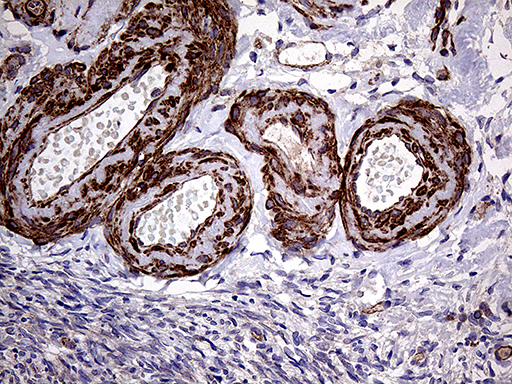 Immunohistochemical staining of paraffin-embedded Human Ovary tissue within the normal limits using anti-TRMT12 mouse monoclonal antibody